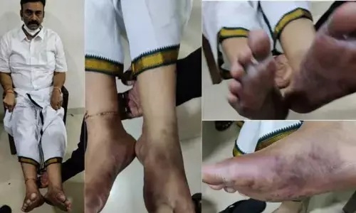 மதமாற்றம் பற்றிய உண்மைகளை வெளிப்படுத்திய எம்.பியை கைது செய்து கொடுமைப்படுத்திய காவல்துறை!