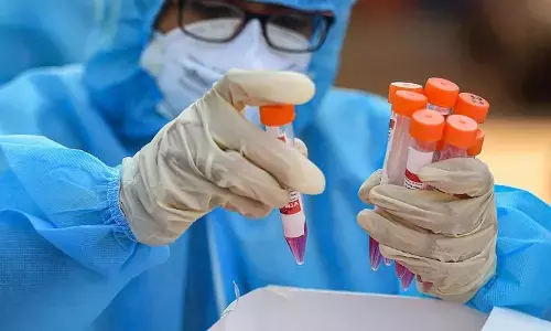 கொரோனாவால் இறந்த குடும்பங்களுக்கு மாதந்தோறும் ஓய்வூதியம் : மத்திய அரசின் அதிரடி உத்தரவு.!