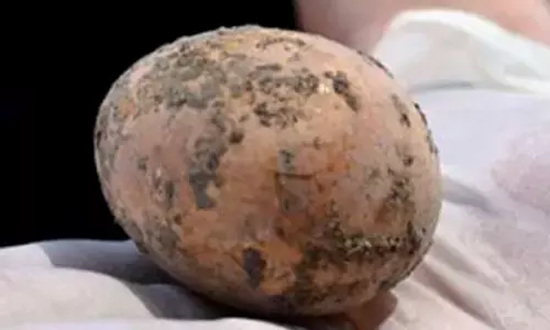 இஸ்ரேலில் அதிசயம்.. 1000 ஆண்டுகள் பழமையான கோழி முட்டை கழிவுநீர் தொட்டியில் கண்டெடுப்பு.!