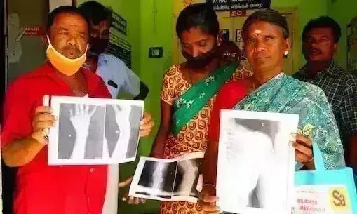 மருத்துவமனையில்  ஃபிலிம் வாங்க விடியல் அரசிடம் காசு இல்லையாம், அதனால் பேப்பர் மற்றும் வாட்ஸ் அப்பில்  முடிவுகள்  !