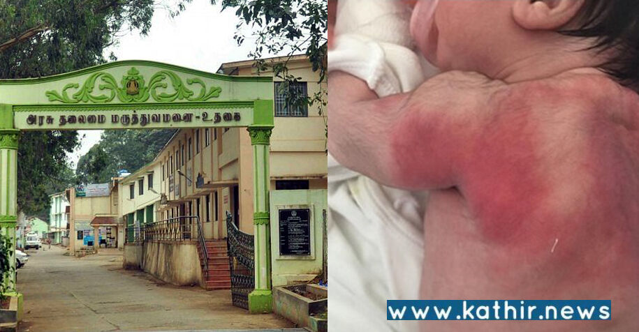 குன்னூரில் அதிர்ச்சி: அரசு மருத்துவமனை கழிவுநீர் தொட்டியில் சிசுவின் சடலம்!