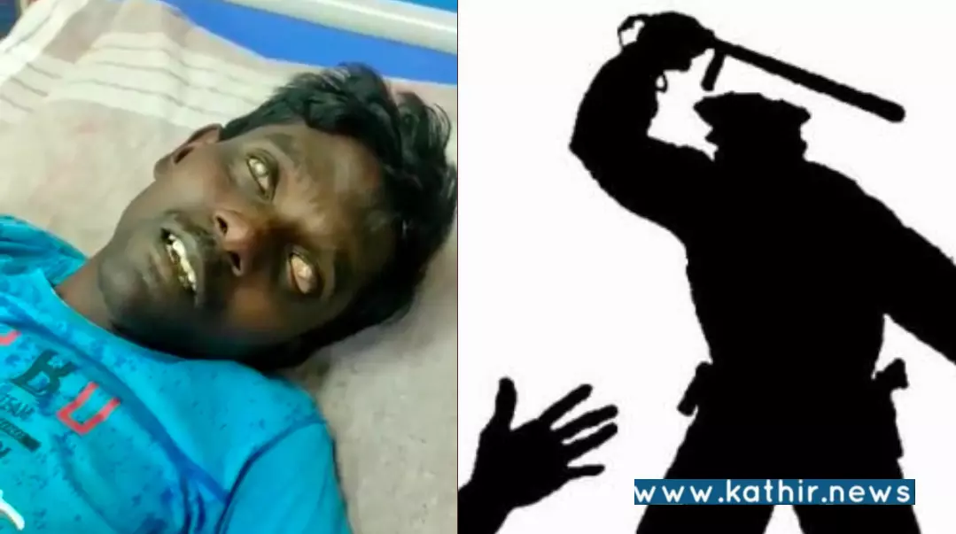 தி.மு.க ஆட்சியில் மது குறித்து புகார் அளித்த கண் பார்வையற்றவர் மீது காவல்துறையினர் வெறி தாக்குதல்! தி.மு.க ஆட்சியில் மது குறித்து புகார் அளித்த கண் பார்வையற்றவர் மீது காவல்துறையினர் வெறி தாக்குதல்!