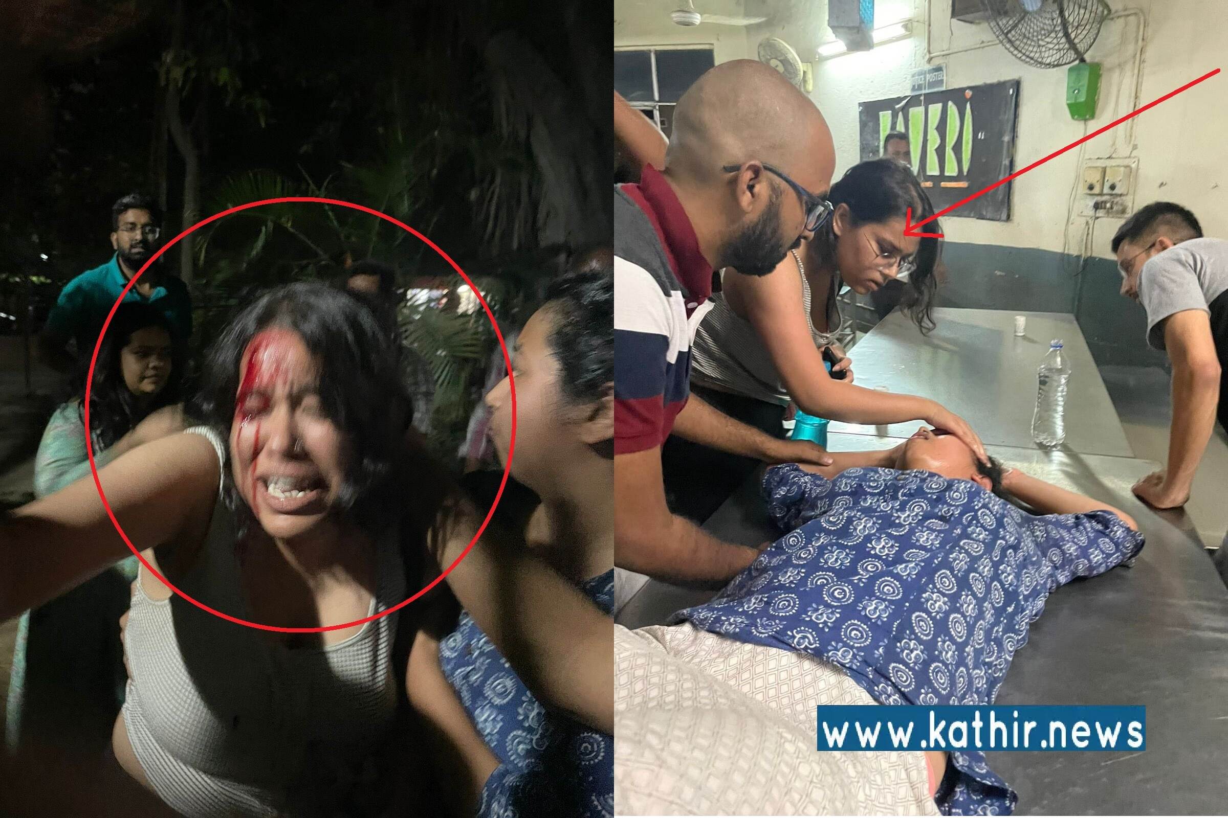 இது தான் ரத்தம் சொட்ட சொட்ட வழிந்த நெற்றியா? அம்பலமான இடதுசாரிகளின் போலி முகத்திரை! சந்தி சிரிக்கும் ஜவஹர்லால் நேரு பல்கலைக்கழக விவகாரம்!