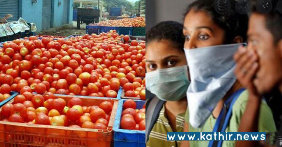கேரளாவில் தக்காளி காய்ச்சல் - தமிழகத்தில் பாதிப்பு ஏற்படுத்துமா? சுகாதாரத்துறை என்ன சொல்கிறது!