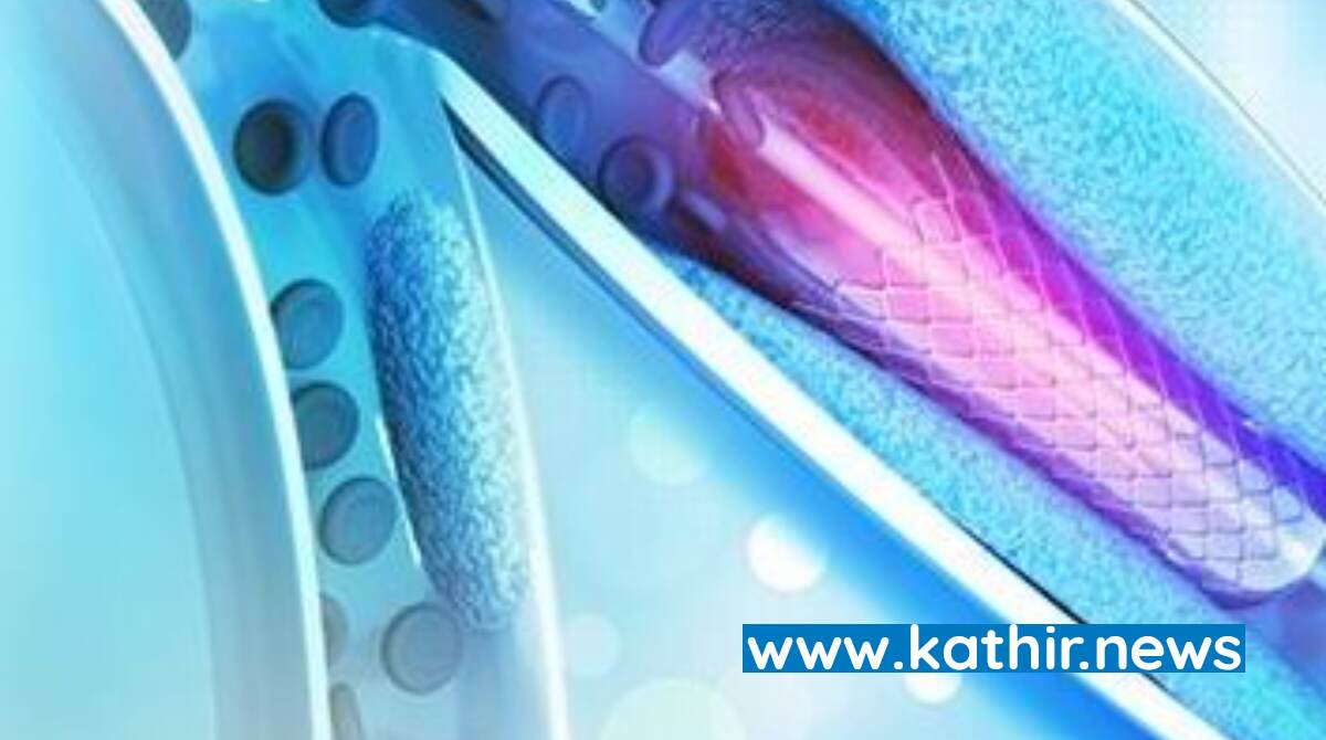 அத்தியாவசிய மருந்து பட்டியலில் இதய 'ஸ்டெண்ட்' சேர்ப்பு- விலை குறைய வாய்ப்பு