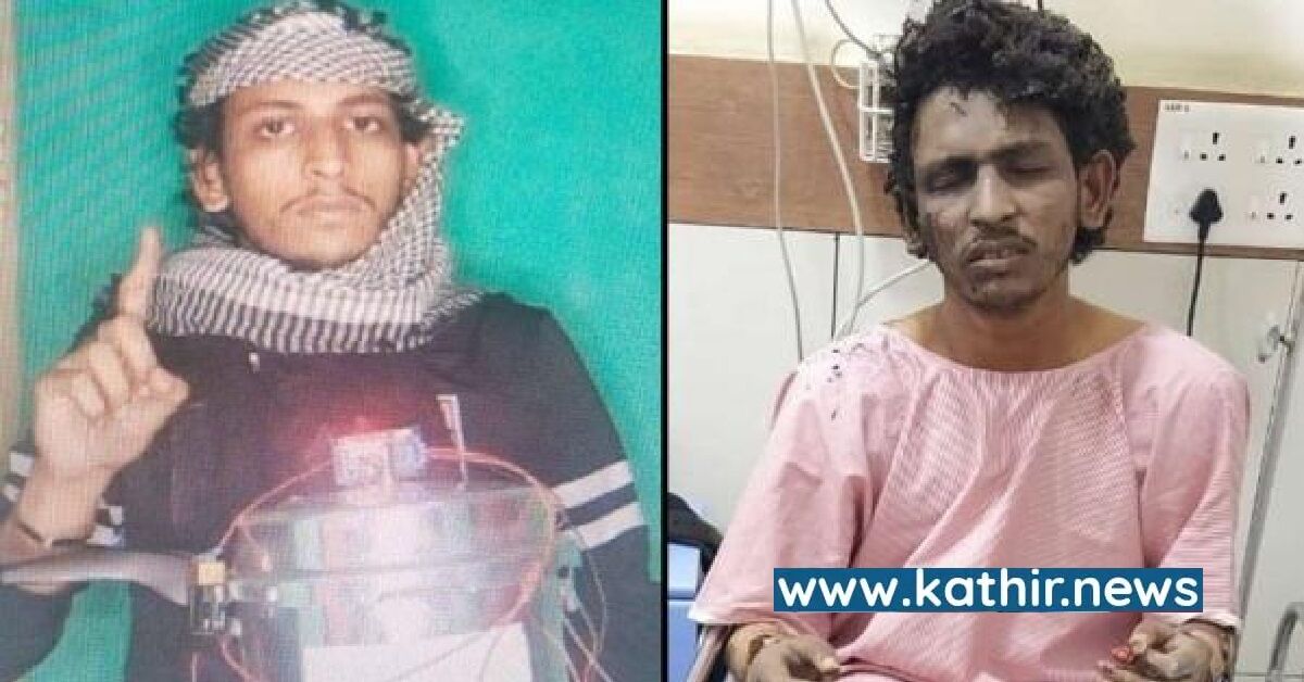 ஆட்டோ குண்டு வெடிப்புக்கு முன்னதாக ஷிமோகாவில் ஒத்திகை பார்த்த ஷரீக் - என்.ஐ.ஏ விசாரணையில் ஷாக்!