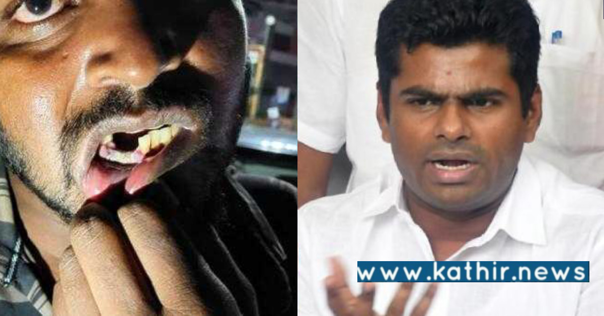 மனிதத் தன்மையற்ற தாக்குதல்.. தமிழக காவல்துறையின் விசாரணை இதுதானா? - சீறிய அண்ணாமலை!