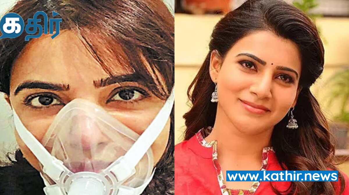நடிகை சமந்தாவுக்கு மீண்டும் சிகிச்சை ரசிகர்கள் அதிர்ச்சி