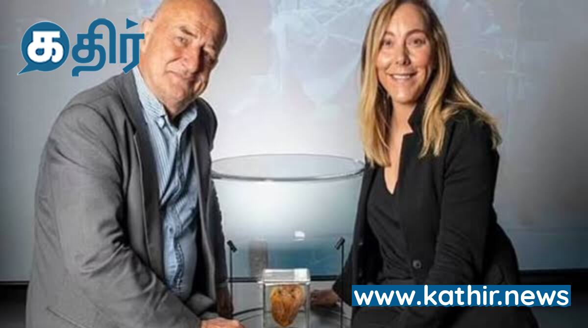 ஏய் எப்புட்றா? - 16 ஆண்டுகளுக்குப் பிறகு தனது சொந்த இதயத்தை ஆச்சரியத்துடன் நேரில் பார்த்த பெண்!