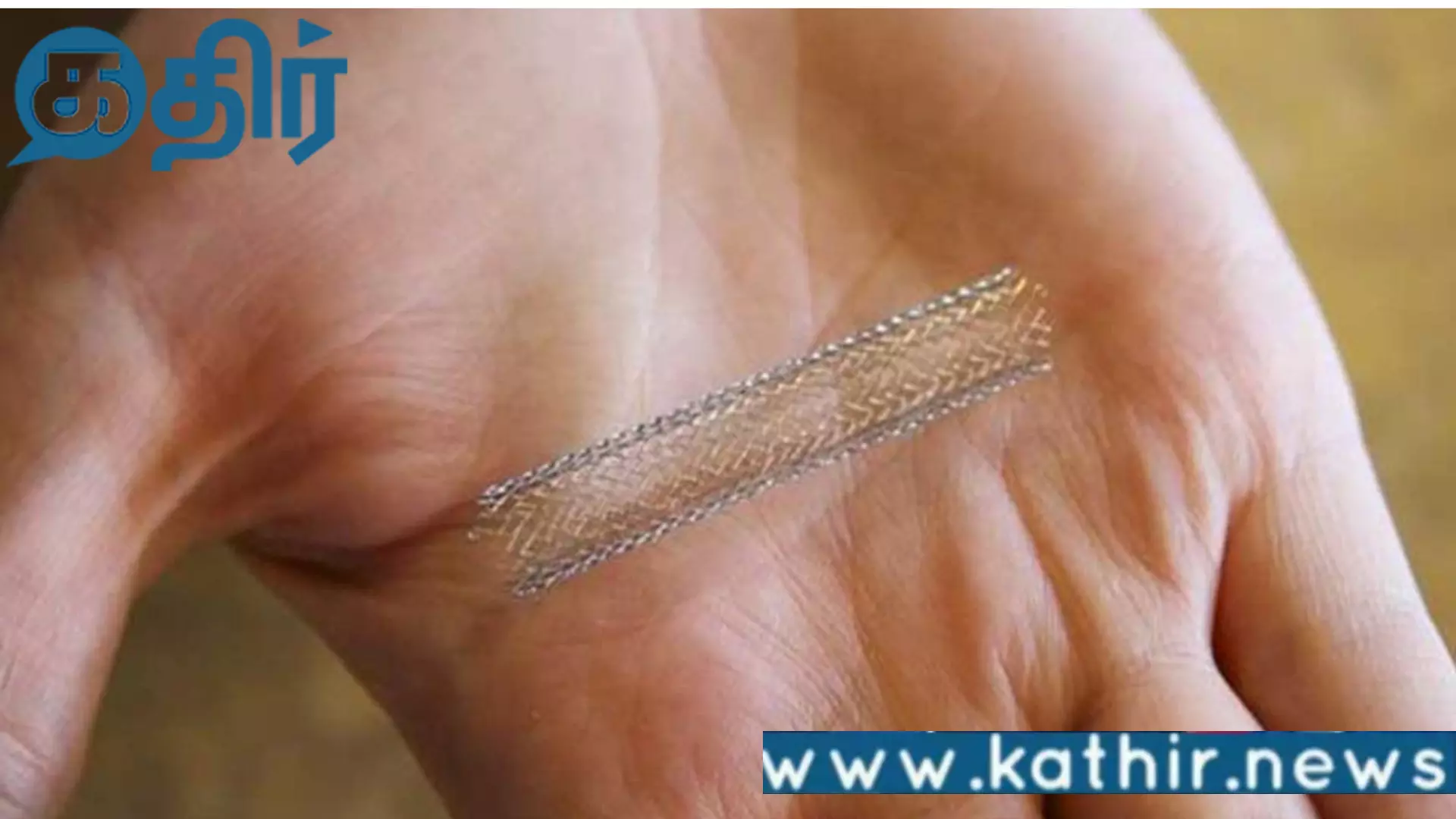 சர்வதேச தரத்தில் இருக்கும் இதய ஸ்டென்ட்டுக்கு டஃப் கொடுக்கும் இந்திய புதிய தலை​முறை இதய ஸ்டென்ட்​டு!!