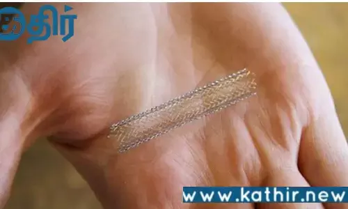 சர்வதேச தரத்தில் இருக்கும் இதய ஸ்டென்ட்டுக்கு டஃப் கொடுக்கும் இந்திய புதிய தலை​முறை இதய ஸ்டென்ட்​டு!!